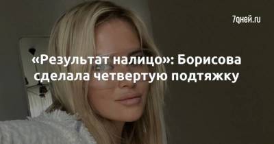 Дан Борисов - «Результат налицо»: Борисова сделала четвертую подтяжку - skuke.net