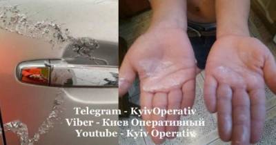 В Киеве неизвестные обливают автомобили кислотой, пострадал ребенок: видео - tsn.ua - Киев - район Деснянский