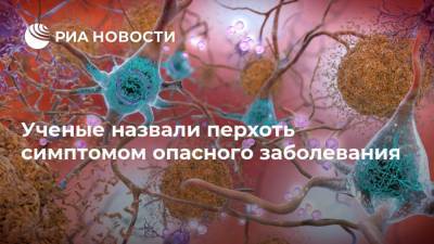 Ученые назвали перхоть симптомом опасного заболевания - ria.ru - Москва