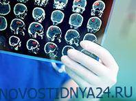 Вирджиния - Неврологи узнали, как уменьшить негативные последствия инсульта - novostidnya24.ru