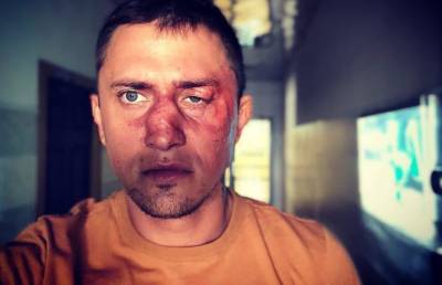 Павел Прилучный - Владимир Семенов - Стало известно, с кем и почему подрался Павел Прилучный - pupolita.ru - Калининград