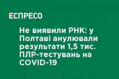 Не выявили РНК: в Полтаве аннулировали результаты 1,5 тыс. ПЦР-тестов на COVID-19 - ru.espreso.tv - Украина - Полтава