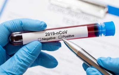 Во Франции - Во Франции начинают первые кампании массового тестирования на коронавирус - rbc.ua - Бельгия - Гавр