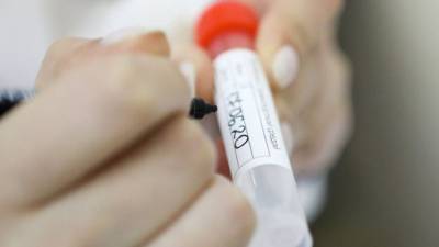 Переболевшие COVID-19 женщины столкнулись с ранней менопаузой - nation-news.ru - Англия - Таиланд