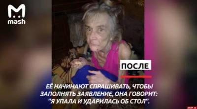 Внук два года избивал и морил голодом свою бабушку - 7info.ru