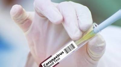 Обнародована география новых случаев коронавируса в области - penzainform.ru - Пенза - Каменск - Сосновоборск - Сердобск