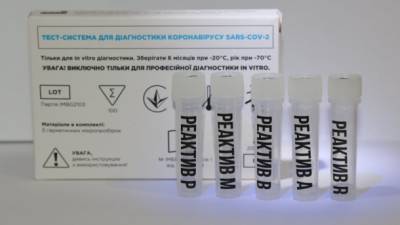 Одновременно определяет COVID-19 и грипп: Украинские ученые создали новый ПЦР-тест - ru.espreso.tv - Киев