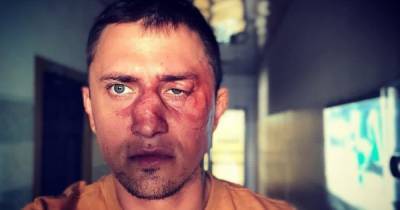 Павел Прилучный - "Насколько я пока понял из СМИ, я подрался за бабушку в гей-клубе": Прилучный — о происшествии в Калининграде - klops.ru - Калининград
