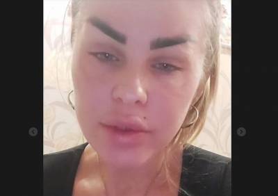 Мать мальчика, пострадавшего а аварии с автобусом под Рязанью, рассказала о его диагнозе - ya62.ru - Рязанская обл. - Рязань - район Скопинский