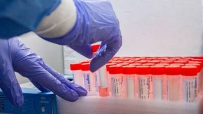 Коронавирус в Израиле: сводка минздрава на утро 9 декабря - vesty.co.il - Швейцария - Португалия