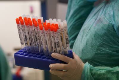 Израиль получил первую партию вакцины от коронавируса - news.24tv.ua - Тель-Авив - Брюссель - Иерусалим