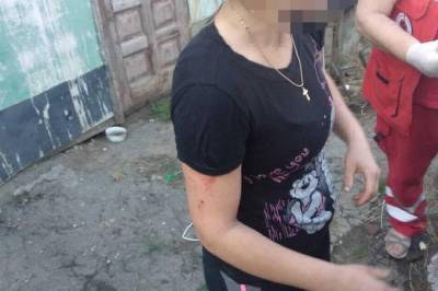 В Одесской области взорвалась граната, которую люди пытались разобрать в собственном доме, есть пострадавшие - vkcyprus.com - Одесская обл.