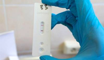 Экспресс-тесты на антитела к COVID-19 на платной основе можно сделать в Центральной поликлинике Могилева - tvr.by - Белоруссия - Могилев