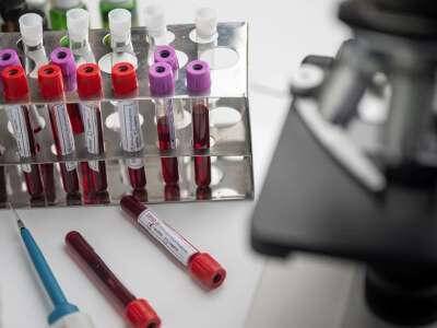 Паскаль Сорио - Раскрыта продолжительность действия вакцины против коронавируса - live24.ru - Англия