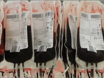 Связь между группой крови и тяжестью коронавируса подтверждена - live24.ru - Китай - США - Колумбия - Иран