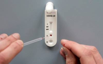 Подтверждена связь между группой крови и тяжестью COVID - korrespondent.net - Китай - США - Колумбия - Германия - Иран