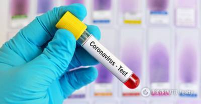 Коронавирус в Украине - статистика на 25 июня - онлайн-карта COVID-19 - obozrevatel.com - Россия - США - Украина - Бразилия - Индия