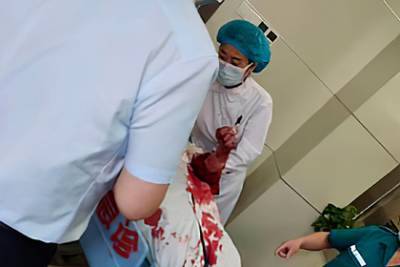 Пациент напал с ножом на врача из-за невылеченной импотенции - lenta.ru - Китай - Чжэнчжоу - штат Мэн