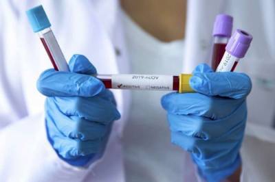 За последние сутки в Украине подтвердили 612 новых случаев коронавируса - vkcyprus.com - Украина