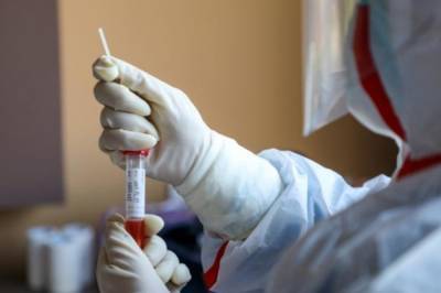 Во Львове коронавирусом заболели 11 работников медицинской лаборатории - vkcyprus.com - Львов - Львовская обл.
