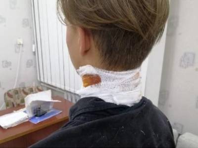 В Херсоне мужчина целился в трубу, но прострелил из пистолета подростку шею - golos.ua - Херсон - Херсонская обл.