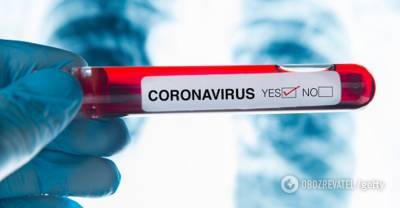 Коронавирус в Украине - статистика на 2 июля - онлайн-карта COVID-19 - obozrevatel.com - Россия - США - Украина - Бразилия - Индия