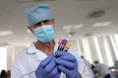 Сроки тестирования на антитела к COVID-19 продлили для жителей столицы - vm.ru - Москва