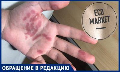 Экомаркет калечит клиентов сухим льдом, рассказал покупатель - bloknot.ru