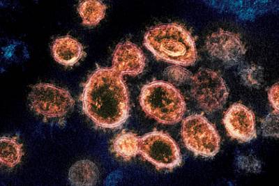 Исследователи назвали коронавирус непобедимым - rusjev.net - шт. Миннесота
