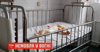 Медики стабилизировали 8-месячного малыша, которого случайно поджег братик - tsn.ua