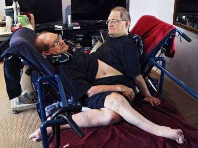 В США умерли старейшие в мире сиамские близнецы - golos.ua - США - шт. Огайо - Дейтон