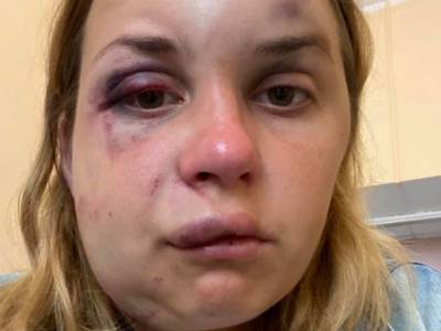 В поезде пассажирку избили и пытались изнасиловать - golos.ua - Украина - Киев - Запорожье - Мариуполь