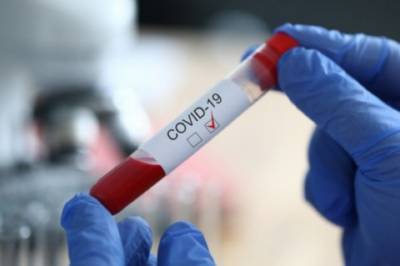 В мире уже более 20 млн человек заразились COVID-19 - vkcyprus.com - США - Бразилия - Индия