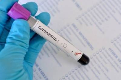 За сутки в Украине подтвердили более 1 тысячи новых случаев коронавируса - vkcyprus.com - Украина