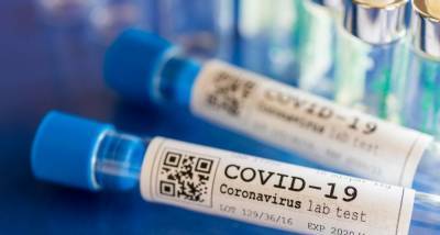 В Израиле выявляют коронавирус за считанные секунды - aze.az - Израиль