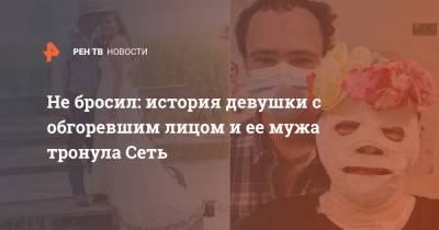 Не бросил: история девушки с обгоревшим лицом и ее мужа тронула Сеть - ren.tv - Австралия - Мельбурн