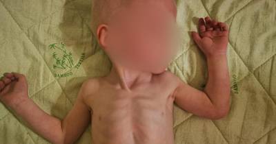 Между жизнью и смертью: мальчика довели до истощения в детдоме в Крыму - ren.tv - Крым