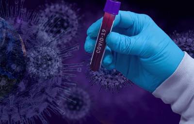 Положительный тест на коронавирус сдал Усэйн Болт - live24.ru - США