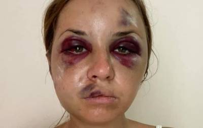 Анастасия Луговая - Избитая в поезде рассказала, как спаслась - korrespondent.net - Нападение