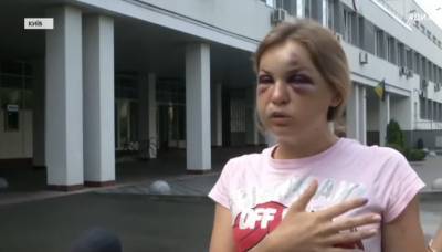 Анастасия Луговая - Муж журналистки, которую избили в поезде, рассказал о самочувствии сына: "Прости, что я ..." - politeka.net - Киев - Мариуполь