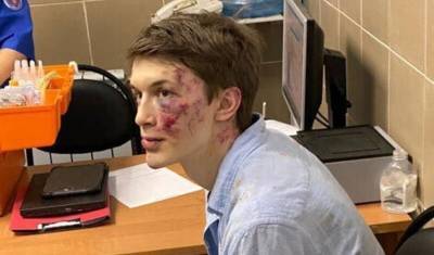 Егор Жуков - Полиция начала расследование нападения на Егора Жукова - newizv.ru - Москва - Россия