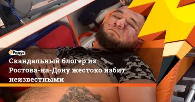 Блогер - Скандальный блогер из Ростова-на-Дону жестоко избит неизвестными - ridus.ru - Ростов-На-Дону