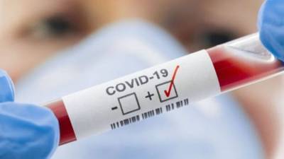 В Украине новый антирекорд: 1271 новый больной COVID-19 за сутки - bykvu.com - Украина - Киев - Ивано-Франковская обл. - Харьковская обл. - Кировоградская обл. - Львовская обл.