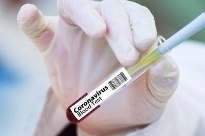 Максим Степанов - На Украине зафиксирован антирекорд по числу новых случаев COVID-19 - aif.ru - Украина