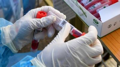 В Китае предупредили о распространении нового опасного вируса - iz.ru - Китай