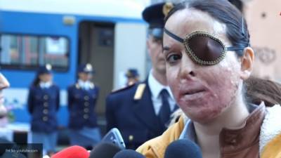 Изувеченная финалистка "Мисс Италии" Джессика Нотаро появилась на публике - nation-news.ru - Италия