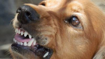 В Находке стая собак напала на 8-летнюю девочку - piter.tv - Мексика - Приморье край