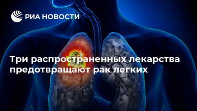 Три распространенных лекарства предотвращают рак легких - ria.ru - Москва - Южная Корея