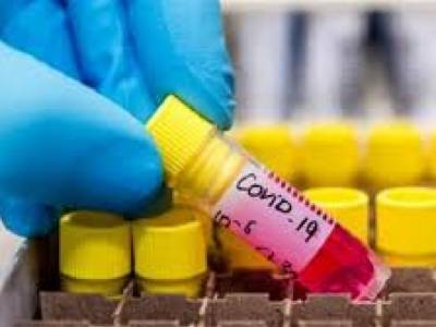 Дир Джадд - США отказались разрабатывать вакцину от коронавируса под эгидой «коррумированной ВОЗ» - golos.ua - Китай - США