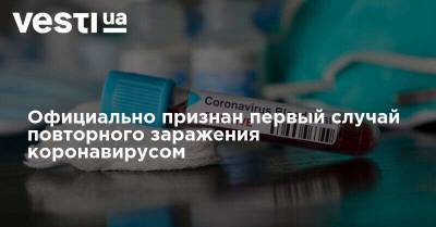 Шолбан Кара-Оол Тувы - Федор Лисицын - Официально признан первый случай повторного заражения коронавирусом - vesti.ua